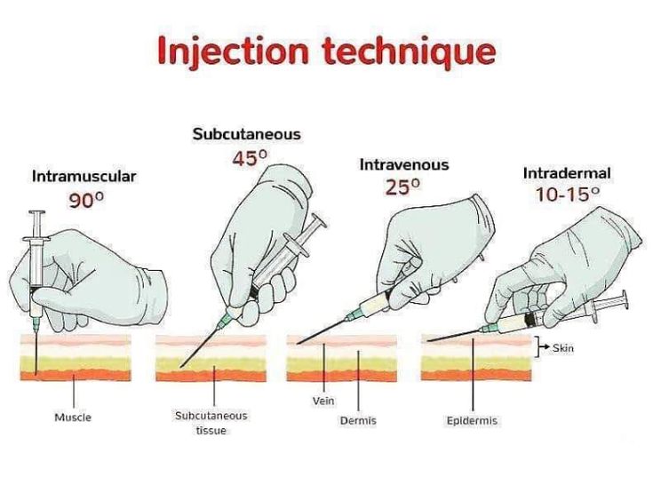 On-Call Injection